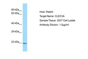 CLEC3A Antibody -  This image was taken for the unconjugated form of this product. Other forms have not been tested.