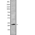 CLEC3B / Tetranectin Antibody - Western blot analysis of CLEC3B using HepG2 whole cells lysates
