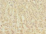 CLEC4C / CD303 / BDCA-2 Antibody - Immunohistochemistry of paraffin-embedded human adrenal gland tissue using antibody at dilution of 1:100.