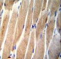 CLEC4F Antibody - CLEC4F Antibody immunohistochemistry of formalin-fixed and paraffin-embedded human skeletal muscle followed by peroxidase-conjugated secondary antibody and DAB staining.