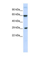 CLEC4M / L-SIGN / CD299 Antibody - CLEC4M / CD299 antibody Western blot of Fetal Muscle lysate. This image was taken for the unconjugated form of this product. Other forms have not been tested.