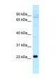 CLEC5A / MDL-1 Antibody - CLEC5A antibody Western blot of COL0205 Cell lysate. Antibody concentration 1 ug/ml.  This image was taken for the unconjugated form of this product. Other forms have not been tested.