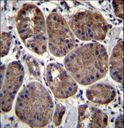CLEC7A / Dectin 1 Antibody - CLEC7A Antibody immunohistochemistry of formalin-fixed and paraffin-embedded human stomach tissue followed by peroxidase-conjugated secondary antibody and DAB staining.