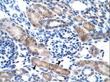 CLIC1 / NCC27 Antibody - CLIC1 antibody ARP35045_T100-NP_001279-CLIC1 (chloride intracellular channel 1) Antibody was used in IHC to stain formalin-fixed, paraffin-embedded human kidney.  This image was taken for the unconjugated form of this product. Other forms have not been tested.