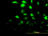 CLIC3 Antibody - Immunofluorescence of monoclonal antibody to CLIC3 on HeLa cell (antibody concentration 15 ug/ml).