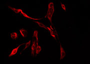 CLIC6 Antibody - Staining HepG2 cells by IF/ICC. The samples were fixed with PFA and permeabilized in 0.1% Triton X-100, then blocked in 10% serum for 45 min at 25°C. The primary antibody was diluted at 1:200 and incubated with the sample for 1 hour at 37°C. An Alexa Fluor 594 conjugated goat anti-rabbit IgG (H+L) Ab, diluted at 1/600, was used as the secondary antibody.