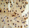 CLIP1 / CLIP-170 Antibody - CLIP1 Antibody IHC of formalin-fixed and paraffin-embedded mouse brain tissue followed by peroxidase-conjugated secondary antibody and DAB staining.