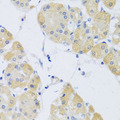 CLIP1 / CLIP-170 Antibody - Immunohistochemistry of paraffin-embedded human stomach tissue.