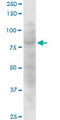 CLLP / CTNNAL1 Antibody - CTNNAL1 monoclonal antibody (M08), clone 3C8. Western blot of CTNNAL1 expression in Jurkat.
