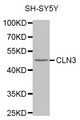 CLN3 Antibody - Western blot analysis of extracts of SH-SY5Y cell line, using CLN3 antibody.