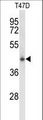 CLN5 Antibody - Western blot of CLN5 Antibody in T47D cell line lysates (35 ug/lane). CLN5 (arrow) was detected using the purified antibody.