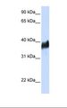 CLN8 Antibody - 293T cell lysate. Antibody concentration: 1.0 ug/ml. Gel concentration: 12%.  This image was taken for the unconjugated form of this product. Other forms have not been tested.