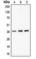 CLNS1A Antibody - Western blot analysis of CLNS1A expression in A549 (A); K562 (B); Jurkat (C) whole cell lysates.