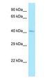 CLP1 Antibody - CLP1 antibody Western Blot of HepG2 cell lysate. CLP1 is supported by BioGPS gene expression data to be expressed in HepG2.  This image was taken for the unconjugated form of this product. Other forms have not been tested.