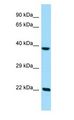 CLPP Antibody - CLPP antibody Western Blot of 293T.  This image was taken for the unconjugated form of this product. Other forms have not been tested.