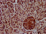 CLPTM1L / CLPTM1-Like Antibody - Immunohistochemistry image at a dilution of 1:800 and staining in paraffin-embedded human pancreatic tissue performed on a Leica BondTM system. After dewaxing and hydration, antigen retrieval was mediated by high pressure in a citrate buffer (pH 6.0) . Section was blocked with 10% normal goat serum 30min at RT. Then primary antibody (1% BSA) was incubated at 4 °C overnight. The primary is detected by a biotinylated secondary antibody and visualized using an HRP conjugated SP system.