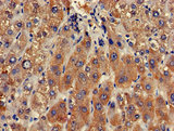 CLRN2 Antibody - Immunohistochemistry of paraffin-embedded human lung tissue using CLRN2 Antibody at dilution of 1:100