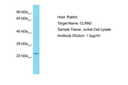 CLRN3 Antibody -  This image was taken for the unconjugated form of this product. Other forms have not been tested.