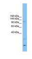 CLSTN3 Antibody - CLSTN3 antibody Western blot of RPMI-8226 cell lysate. This image was taken for the unconjugated form of this product. Other forms have not been tested.