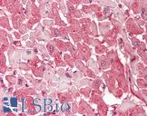 CLTB Antibody - Human Heart: Formalin-Fixed, Paraffin-Embedded (FFPE).  This image was taken for the unconjugated form of this product. Other forms have not been tested.