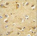 CLTC / Clathrin Heavy Chain Antibody - CLTC antibody immunohistochemistry of formalin-fixed and paraffin-embedded human brain tissue followed by peroxidase-conjugated secondary antibody and DAB staining.