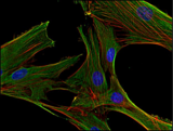 CLTC / Clathrin Heavy Chain Antibody - Immunofluorescence staining of clathrin in human primary fibroblasts using anti-clathrin (BF-06; green). Actin cytoskeleton decorated by phalloidin (red) and cell nuclei stained with DAPI (blue).