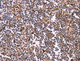 CLUAP1 Antibody - Immunohistochemistry of paraffin-embedded Human tonsil using CLUAP1 Polyclonal Antibody at dilution of 1:50.