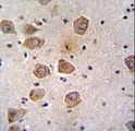CLVS2 Antibody - RLBP1L2 Antibody immunohistochemistry of formalin-fixed and paraffin-embedded human brain tissue followed by peroxidase-conjugated secondary antibody and DAB staining.