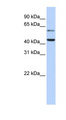 CMAS Antibody - CMAS antibody Western blot of Fetal Brain lysate. This image was taken for the unconjugated form of this product. Other forms have not been tested.
