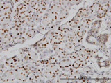 CMAS Antibody - Immunoperoxidase of monoclonal antibody to CMAS on formalin-fixed paraffin-embedded human salivary gland (antibody concentration 3 ug/ml).
