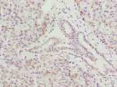 CMC1 Antibody - Immunohistochemistry of paraffin-embedded human pancreatic tissue using antibody at dilution of 1:100.