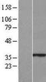 CMSS1 Protein - Western validation with an anti-DDK antibody * L: Control HEK293 lysate R: Over-expression lysate