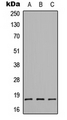 CMTM1 Antibody - Western blot analysis of CMTM1 expression in HEK293T (A); Raw264.7 (B); H9C2 (C) whole cell lysates.