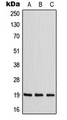 CNBP / ZNF9 Antibody - Western blot analysis of ZNF9 expression in MCF7 (A); NIH3T3 (B); Raw264.7 (C) whole cell lysates.