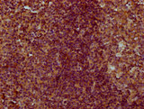 CNFN Antibody - Immunohistochemistry Dilution at 1:300 and staining in paraffin-embedded human tonsil tissue performed on a Leica BondTM system. After dewaxing and hydration, antigen retrieval was mediated by high pressure in a citrate buffer (pH 6.0). Section was blocked with 10% normal Goat serum 30min at RT. Then primary antibody (1% BSA) was incubated at 4°C overnight. The primary is detected by a biotinylated Secondary antibody and visualized using an HRP conjugated SP system.