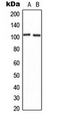 CNGB1 Antibody - Western blot analysis of CNGB1 expression in U2OS (A); NIH3T3 (B) whole cell lysates.