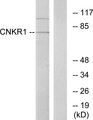 CNKSR1 Antibody - Western blot analysis of lysates from COLO205 cells, using CNKR1 Antibody. The lane on the right is blocked with the synthesized peptide.