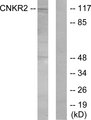 CNKSR2 Antibody - Western blot analysis of lysates from Jurkat cells, using CNKR2 Antibody. The lane on the right is blocked with the synthesized peptide.