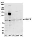 CNOT10 Antibody - Detection of human and mouse CNOT10 by western blot. Samples: Whole cell lysate (50 µg) from HeLa, HEK293T, Jurkat, mouse TCMK-1, and mouse NIH 3T3 cells prepared using NETN lysis buffer. Antibody: Affinity purified rabbit anti-CNOT10 antibody used for WB at 0.04 µg/ml. Detection: Chemiluminescence with an exposure time of 30 seconds.