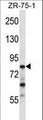CNOT3 Antibody - CNOT3 Antibody western blot of ZR-75-1 cell line lysates (35 ug/lane). The CNOT3 antibody detected the CNOT3 protein (arrow).