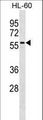 CNOT4 / CLONE243 Antibody - CNOT4 Antibody western blot of HL-60 cell line lysates (35 ug/lane). The CNOT4 antibody detected the CNOT4 protein (arrow).