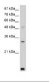 CNOT7 Antibody - HepG2 Cell Lysate.  This image was taken for the unconjugated form of this product. Other forms have not been tested.