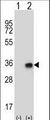 CNOT8 Antibody - Western blot of CNOT8 (arrow) using rabbit polyclonal CNOT8 Antibody. 293 cell lysates (2 ug/lane) either nontransfected (Lane 1) or transiently transfected (Lane 2) with the CNOT8 gene.