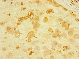 CNPY4 Antibody - Immunohistochemistry of paraffin-embedded human placenta tissue using CNPY4 Antibody at dilution of 1:100