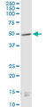 CNR1 / CB1 Antibody - CNR1 monoclonal antibody (M01), clone 2F9. Western Blot analysis of CNR1 expression in rat testis.