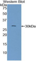 CNTN3 / Contactin 3 Antibody - Western blot of recombinant CNTN3 / Contactin 3.  This image was taken for the unconjugated form of this product. Other forms have not been tested.