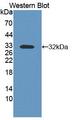 CNTNAP1 / CASPR / p190 Antibody - Western blot of CNTNAP1 / CASPR / p190 antibody.
