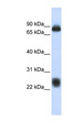 CO-029 / TSPAN8 Antibody - TSPAN8 antibody Western blot of Fetal Brain lysate. This image was taken for the unconjugated form of this product. Other forms have not been tested.