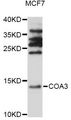 COA3 / CCDC56 Antibody - Western blot analysis of extracts of MCF7 cells, using COA3 antibody at 1:1000 dilution. The secondary antibody used was an HRP Goat Anti-Rabbit IgG (H+L) at 1:10000 dilution. Lysates were loaded 25ug per lane and 3% nonfat dry milk in TBST was used for blocking. An ECL Kit was used for detection and the exposure time was 30s.