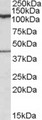 COG1 Antibody - COG1 antibody (0.1 ug/ml) staining of Human Cerebellum lysate (35 ug protein/ml in RIPA buffer). Primary incubation was 1 hour. Detected by chemiluminescence.